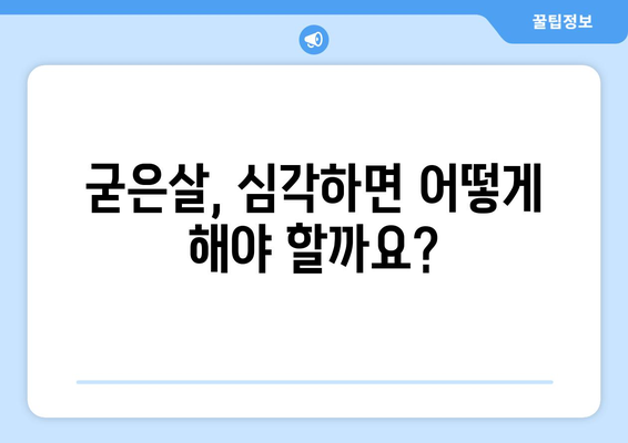 굳은살 원인 분석과 효과적인 제거법