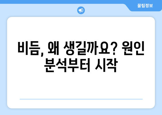 비듬의 원인과 해결 방법 | 종합 가이드