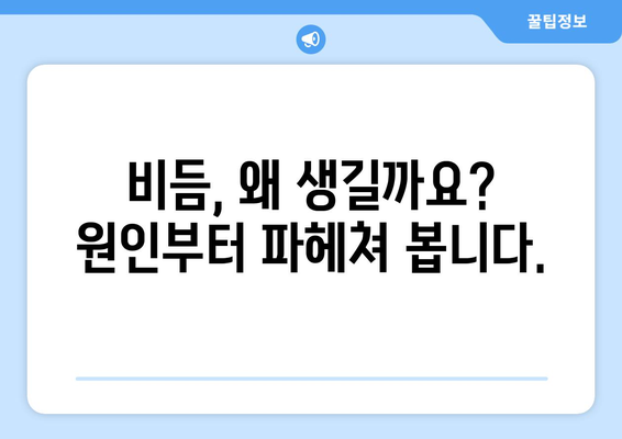 비듬과의 전쟁 | 원인부터 제거까지