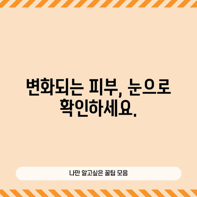 기미 레이저 치료 후기 | 완벽한 기미 제거 여정