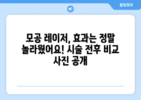 코 모공 레이저 후기 | 놀라운 결과 공개