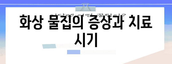 화상 물집 완벽 응급처치 가이드 | 1도, 2도 대응 방법